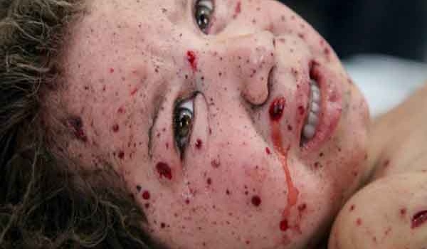 صیہونی جارحیت: بچوں کو جان بوجھ کر نشانہ بنایا