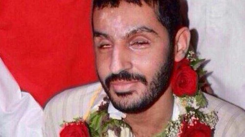 Bahraini regime brutally tortures blind prisoner 'Jaafar Maatouk'