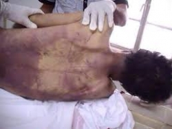 بحرین میں قیدیوں کو ایذائیں دینے کاسلسلہ جاری