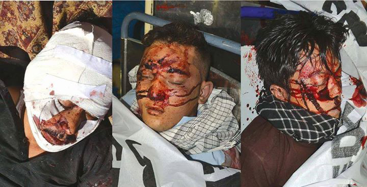 تصاویر : کوئٹہ، زائرین پر دہشتگردوں کا حملہ