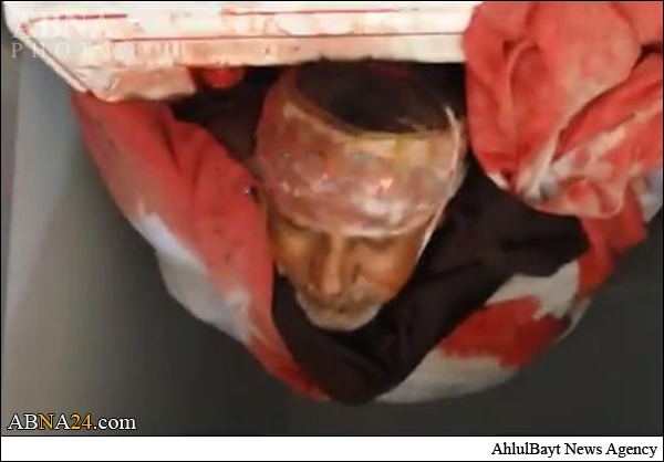 بالصور / مقتل قائد عسكري كبير من أنصار هادي في عدن