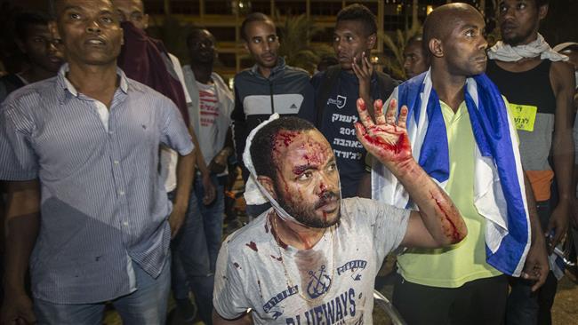 Ethiopians in Israel Protest Racism
