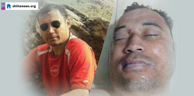 تکفیری دہشتگردوں کی فائرنگ سے زخمی ہونے والے اشرف علی دوران علاج جام شہادت نوش کرگئے
