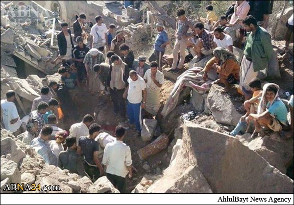 بالصور / جرائم آل سعود بحق أطفال اليمن في مدينة "تعز"
