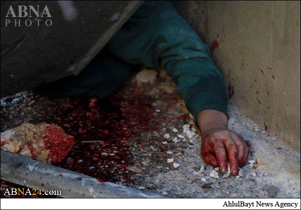 غرب اردن میں انتہائی بے دردی سے ایک فلسطینی نوجوان کی شہادت + تصاویر