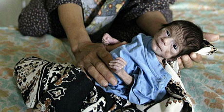 “Medio Millón de Niños Iraquíes Murieron en Iraq Producto de las Sanciones de las Potencias Mundiales”
