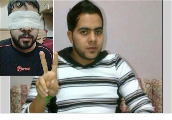 فقدان بصر معتقل سياسي في سجن "جو" بسبب التعذيب والحرمان من العلاج
