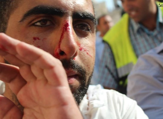 Israeli forces, extremist settlers storm al-Aqsa mosque / Pics