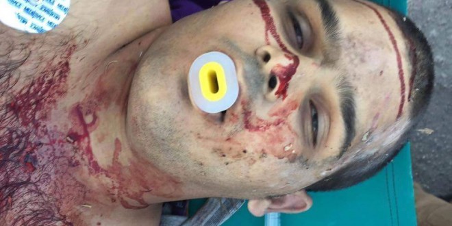 استشهاد فلسطيني بعد طعنه جنديا اسرائيليا بالضفة