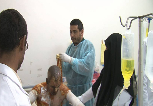 المستشفيات غير قادرة على استيعاب الجرحى جراء العدوان والحصار على اليمن+صور
