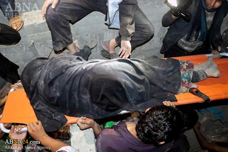 Over 75 killed in new Saudi aggression on Yemen / Photos