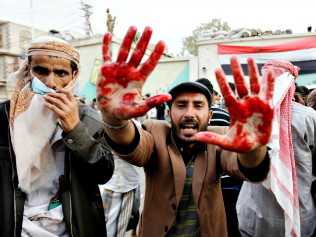 UN: Near 2,700 killed in Saudi aggression against Yemen in 7 months