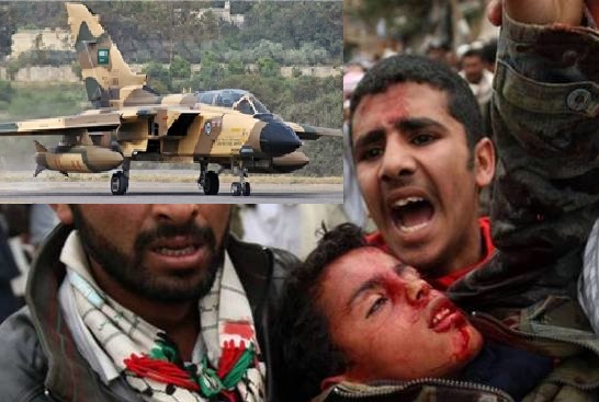 یمن پرسعودی اتحاد کے جنگی طیاروں کی بمباری میں 11 سے زائد عام شہری شہید 