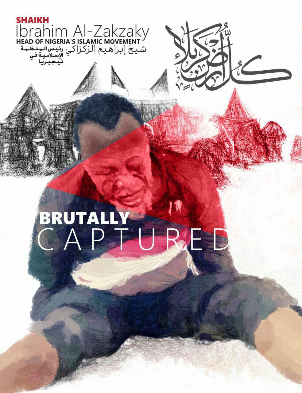 Nigerian Army Published Sheikh Zakzaky's Second Painful Image while Carrying him on a Wheelbarrow!