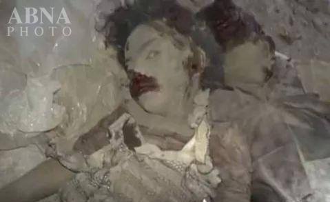 یمن میں سعودیوں کے مظالم نے امریکہ کو بھی پیچھے مار دیا