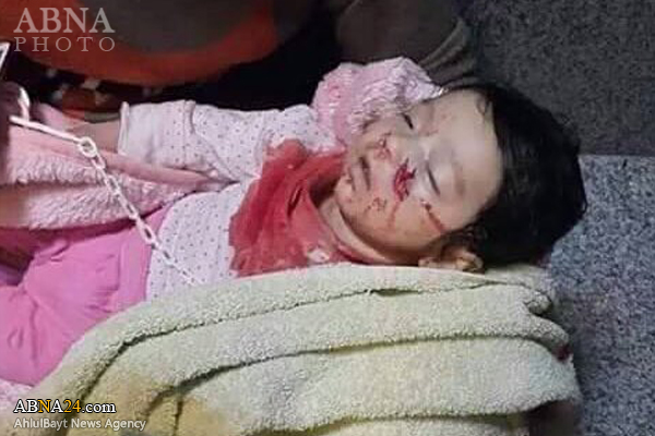 Tentera Turki bunuh bayi Kurdistan (+18)