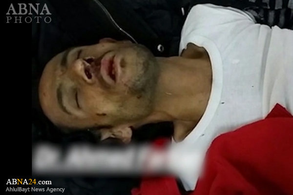 15 قتيلاً و 30 جريحاً من مرتزقة العدوان السعودي بنيران صديقة + (صور)