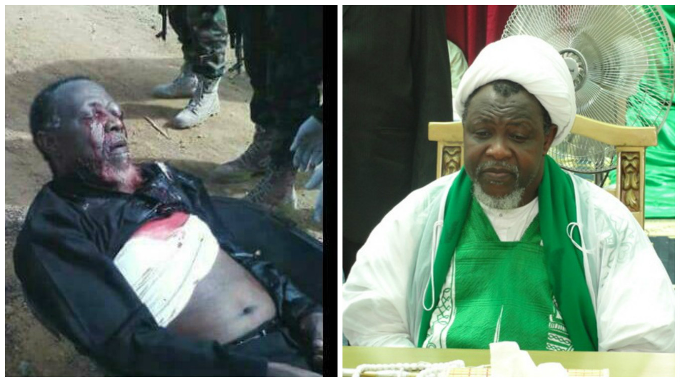 'Sheikh Zakzaky' Currently in Intelligence Ministry's Custody; 6 Bullets Hit Him; He Expresses Deep Regret