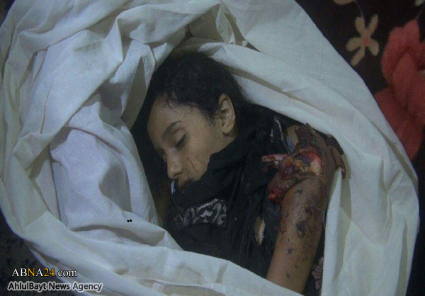 مجزرة جديدة للعدوان السعودي بمحافظة تعز واستشهاد 12 طالبا ومعلمة + صور