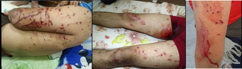 NGOs Condemn Violence Against Protesters on Fifth Anniversary of Bahrain’s Peaceful Uprising