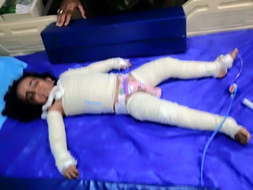 Three-year-old Iraqi girl dies after IS chemical attack  / Pics