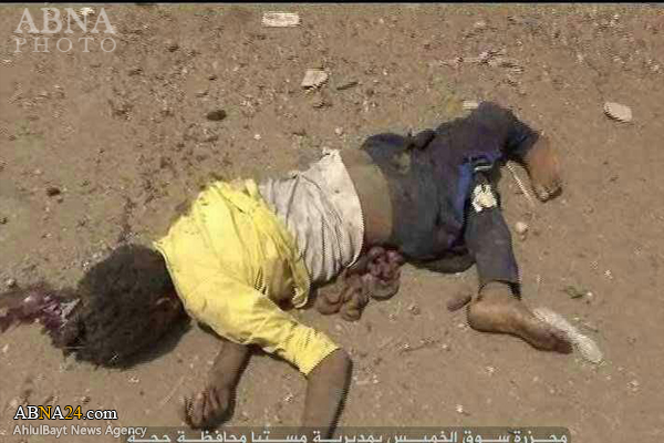 GRAPHIC: Recent Saudi Horrific Genocide in Yemen