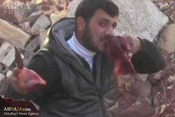  Gaidi mla maini ya watu auawa  Syria+ Picha