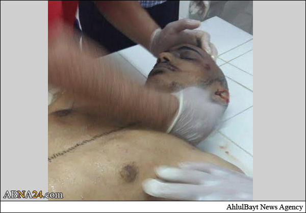 ثقب غائر في صدر الشهيد “عبد الغني” يثبت تعرضه للتصفية المباشرة (صورة +18)