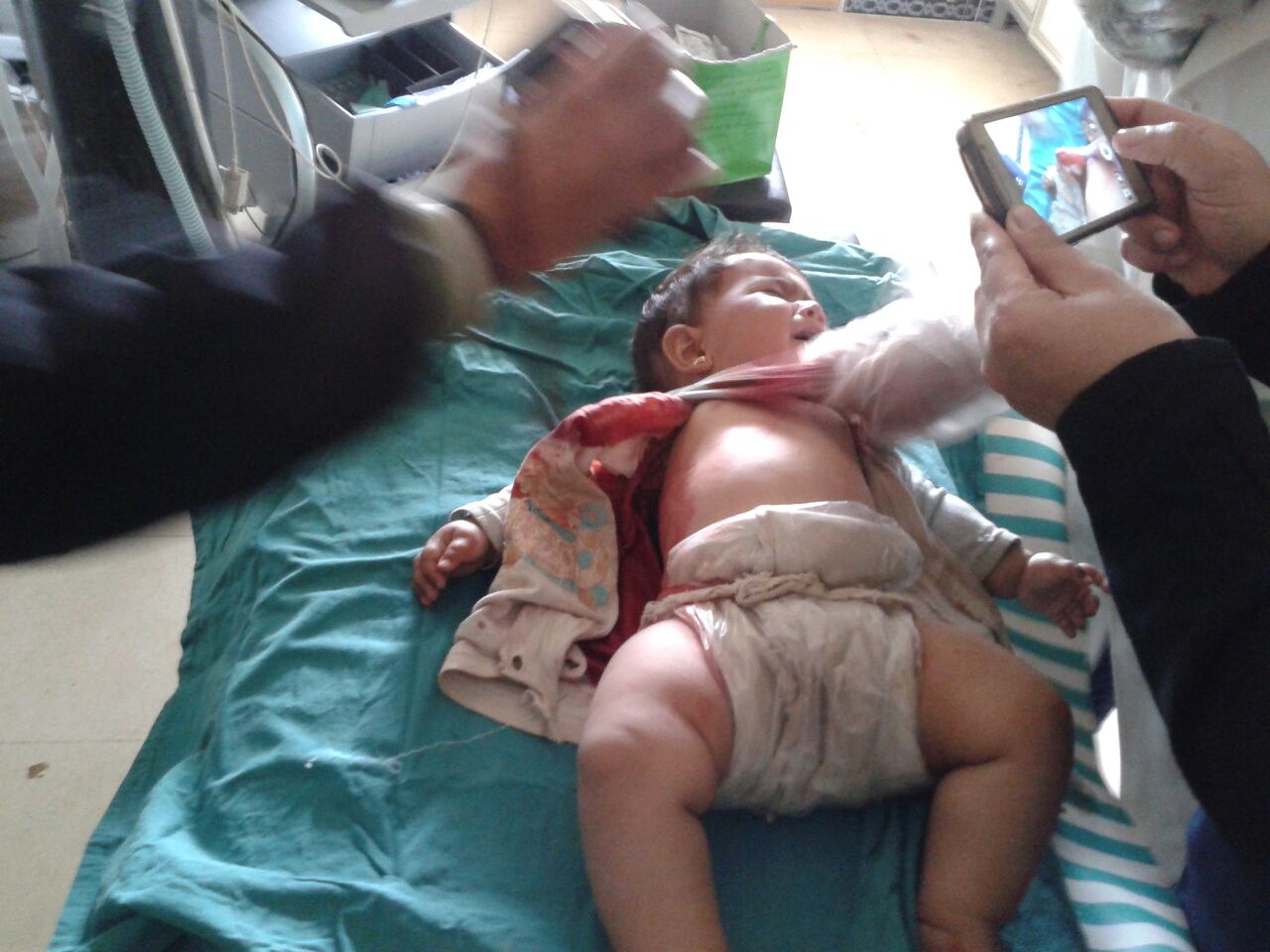 Syria: Three-Month Old Baby Injured from Sniper Fire in Foua