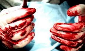 ISIS Begins Illegal Organ Trafficking