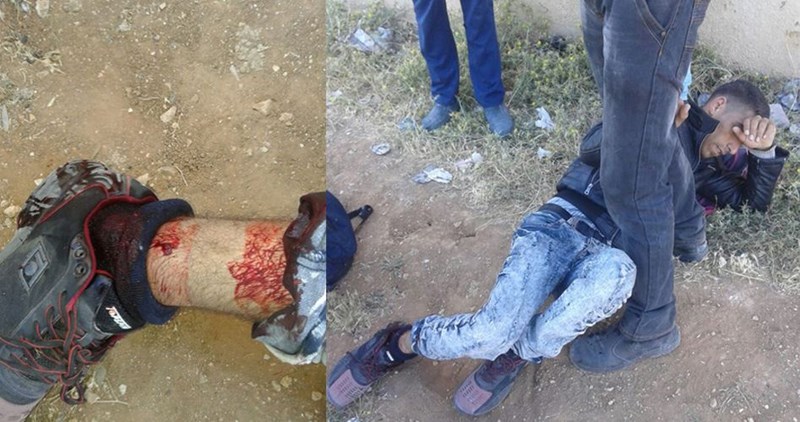 Palestinian young man wounded by Israeli gunfire near Dar Salah village
