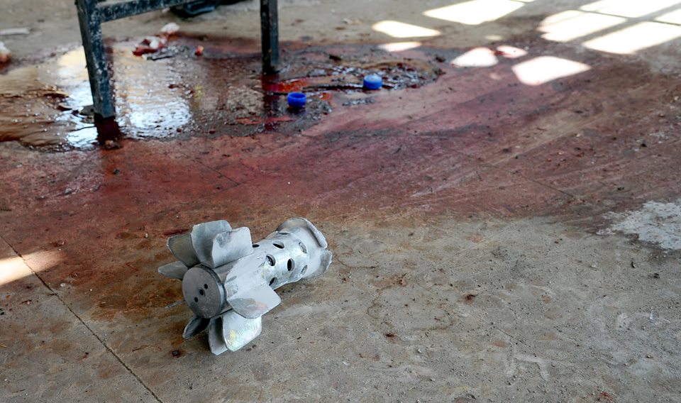 Syrian woman injured in terrorist rocket attack in Aleppo