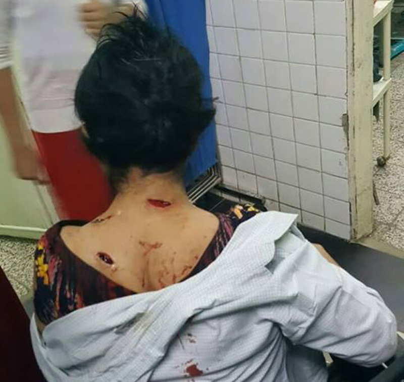  စမ္းေခ်ာင္းျပည္သူ႔လႊတ္ေတာ္အမတ္ ေနအိမ္ကို ေဖာက္ကာ လူသတ္ရန္ ႀကံစည္သည့္ တရားခံ မမိေသး