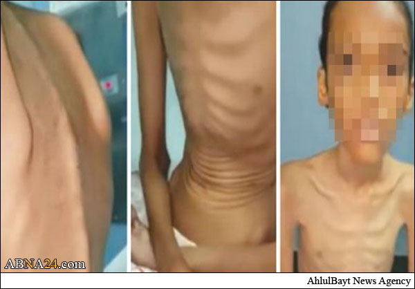 أم سعودية تحبس أطفالها على السطح وتمنع عنهم الطعام ! + (صور صادمة)
