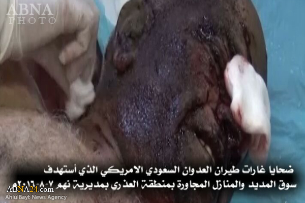 شهداء وجرحى في غارات للعدوان السعودي على صنعاء وحجة (صور16+)