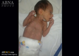 シリア　悲惨な状況にあるシーア派の新生児　