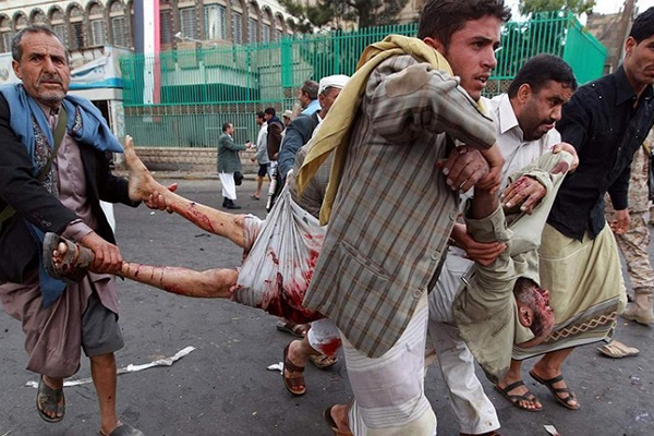 ２２回に渡るサウジのイエメン集中攻撃で、１００人以上が死傷