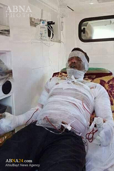 গায়ে আগুন দিয়ে আত্মহত্যার চেষ্টা তিউনিশিয় যুবকের (ছবি)