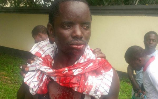 Islamic Movement in Nigeria strongly condemns illegal attack on Free Zakzaky protest In Abuja
