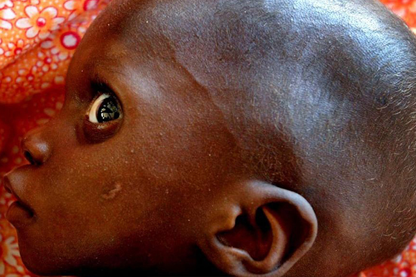 Cerca de 795 milhões de pessoas sofrem de fome crónica ( Dia Mundial de Alimentos)