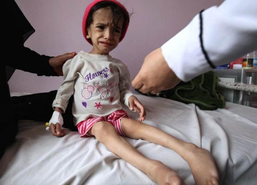 UNICEF upozorava na neuhranjenost jemenske djece