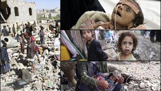 BM: Yemen’in %80’i İnsani Yardıma Muhtaç