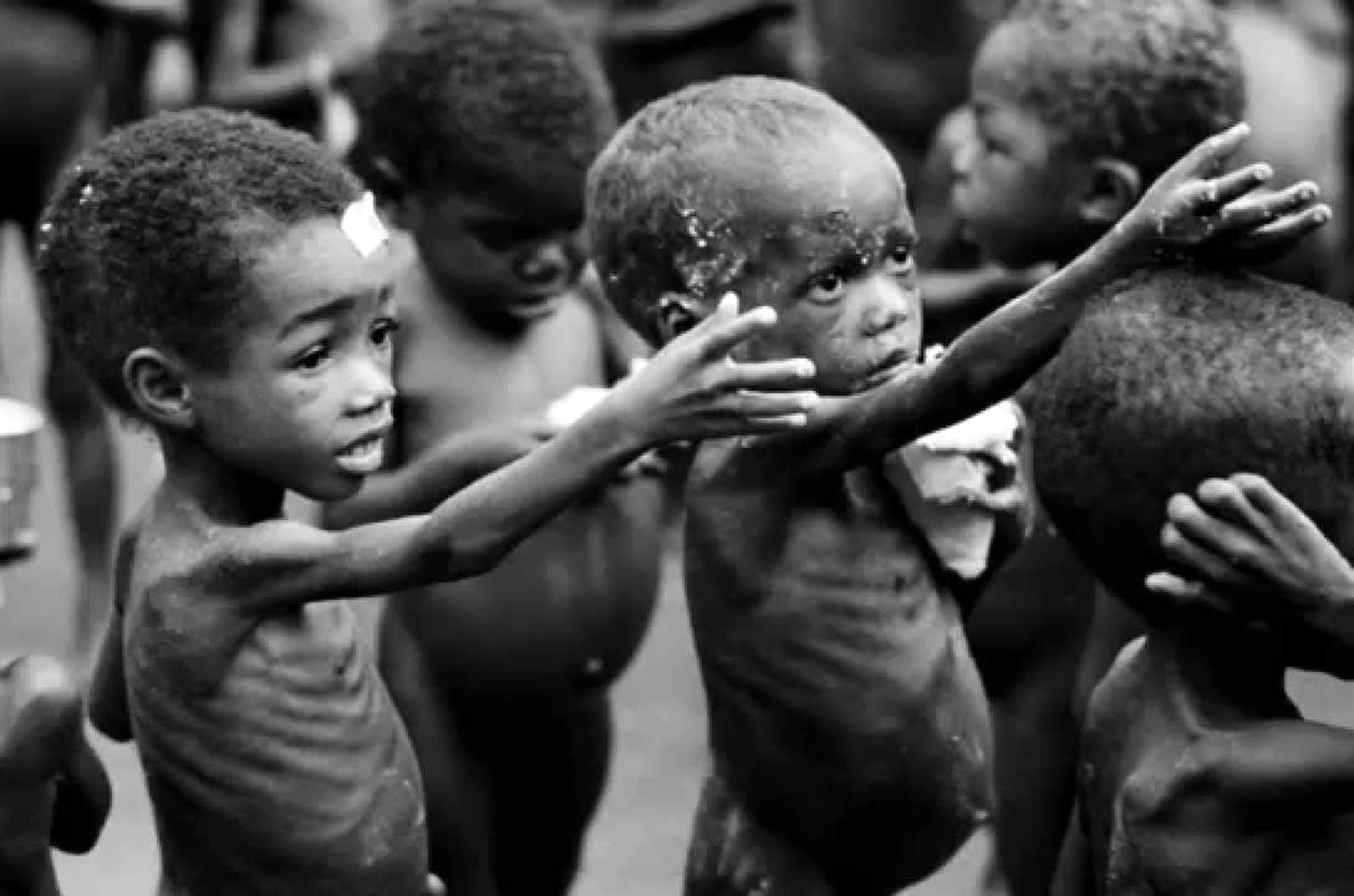 75,000 Nigerian children could starve to death within months, says UN