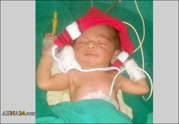 صور لوالدة تنجب طفلتها ورصاصات الـ"شرف" تملأ جسدها! 