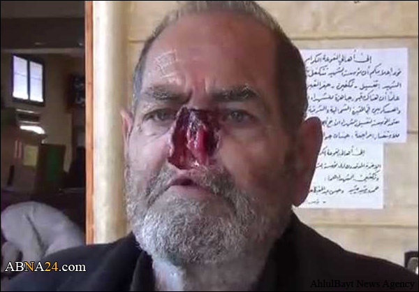 داعش تعاقب احد أهالي حلب بـ قطع أنفه ! (فيديو 16+)