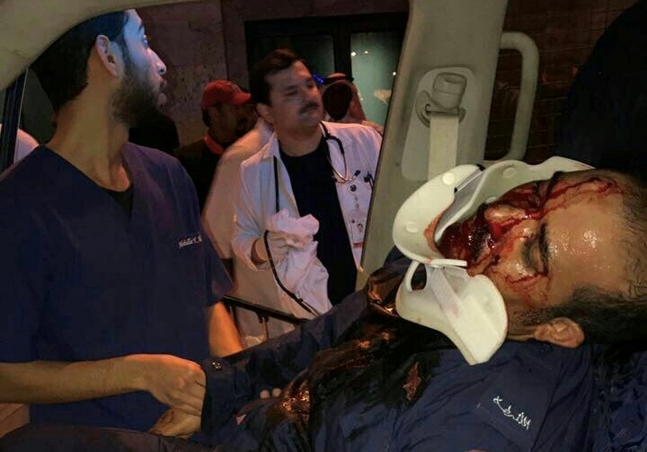 إصابة عنصر امني مرتزق لدى النظام برصاص..وأنباء عن تنفيذ جريمة الإعدام