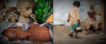 19 Milyon Yəmənli Humanitar köməyə möhtacdır