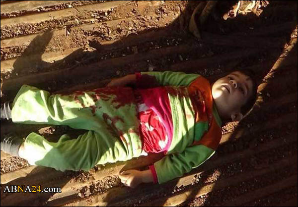 استشهاد طفلة بقصف المسلحين الفوعة في ريف إدلب