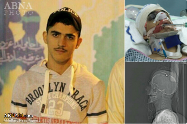 Bahraini forces gravely wound 18-year-old boy in raid on Diraz protests