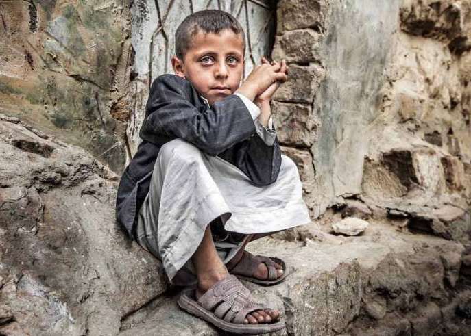 أطفال يمنيون كثيرون يتضورون جوعا بسبب العدوان العسكري السعودي الغاشم